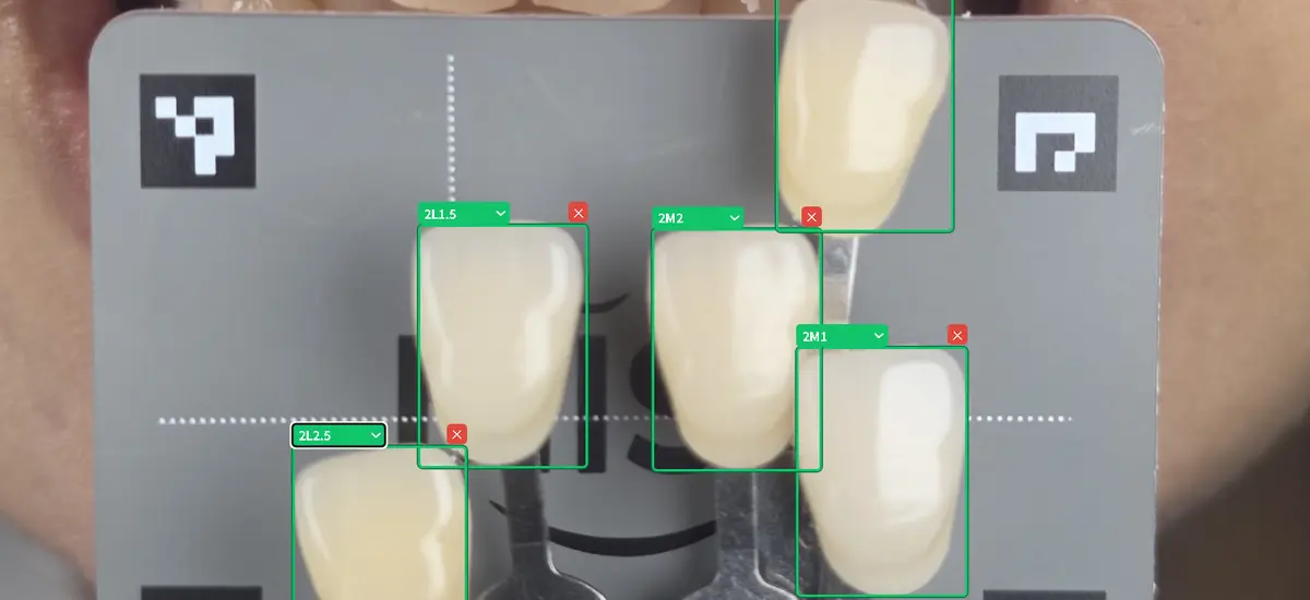 MISO AI shade-tab detection